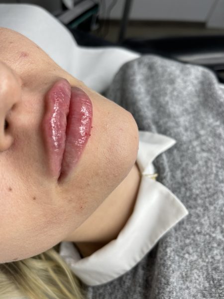 5209AA35 6142 4070 9788 670BDDD40D9F 9bd279a8