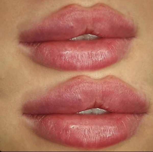 5DC2DB1E D9FA 4E45 B7CC 709B6F175A91 81a16933