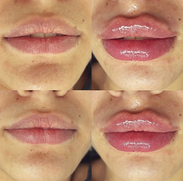 8EE96E06 71F9 4B38 B53C 2669326F528E 9dfb6805